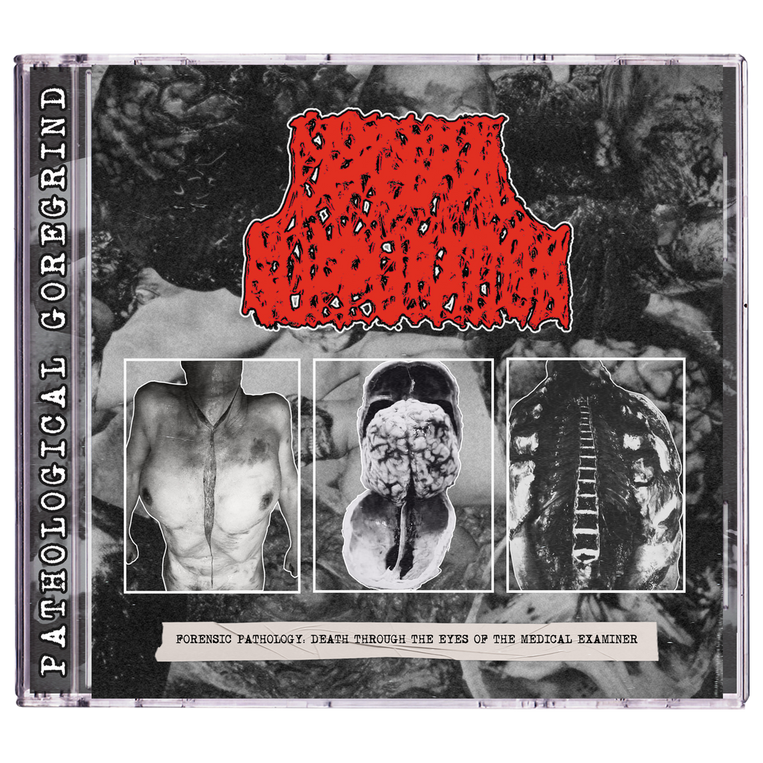 Cerebral Suppuration 'Forensic Pathology' CD
