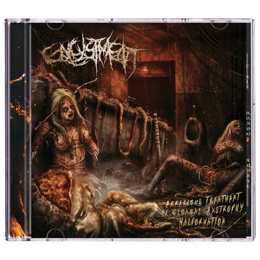 Encystment 'Egregious Treatment of Cloacal Extrophy Malformation' CD