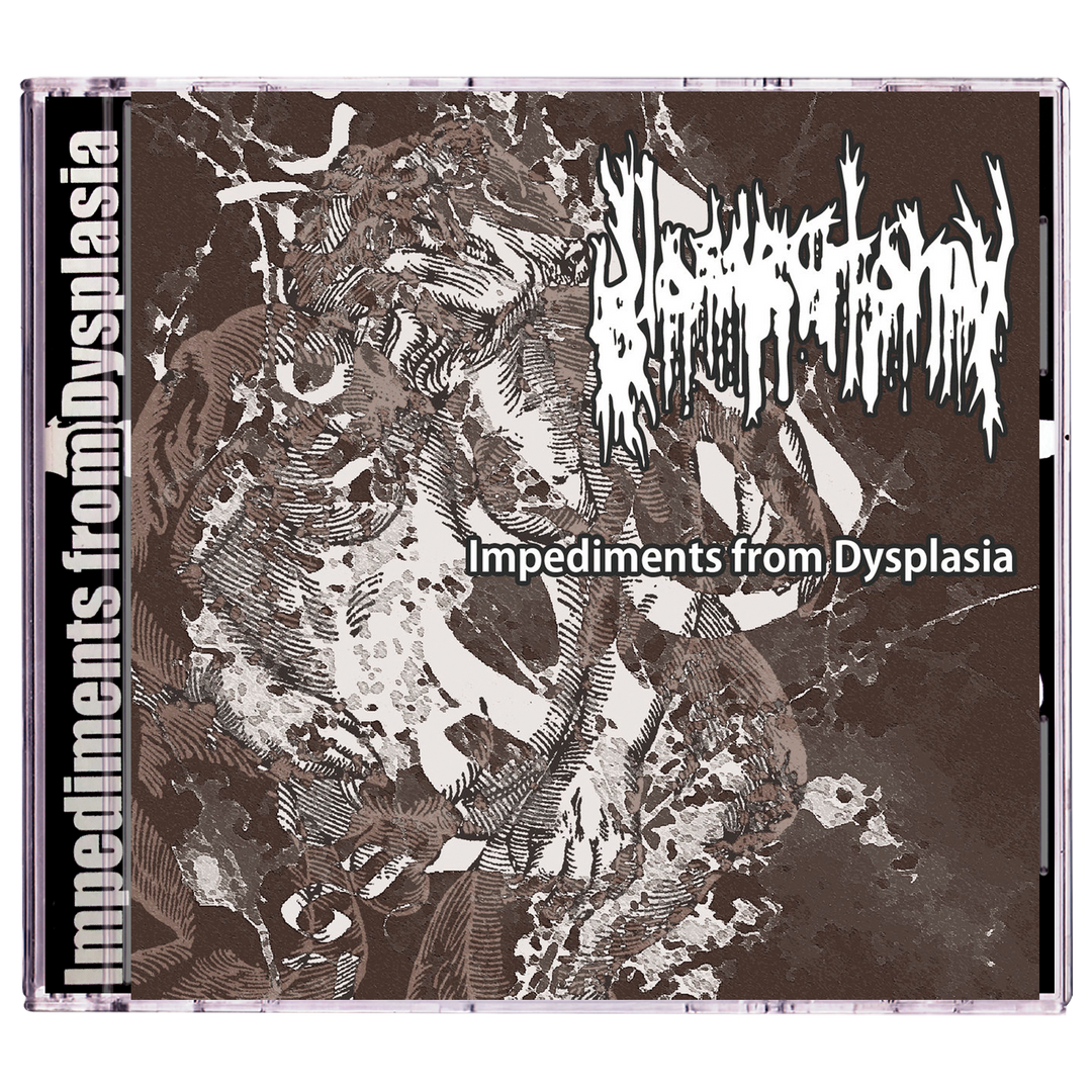 Glossectomy 'Impediments From Dysplasia' CD