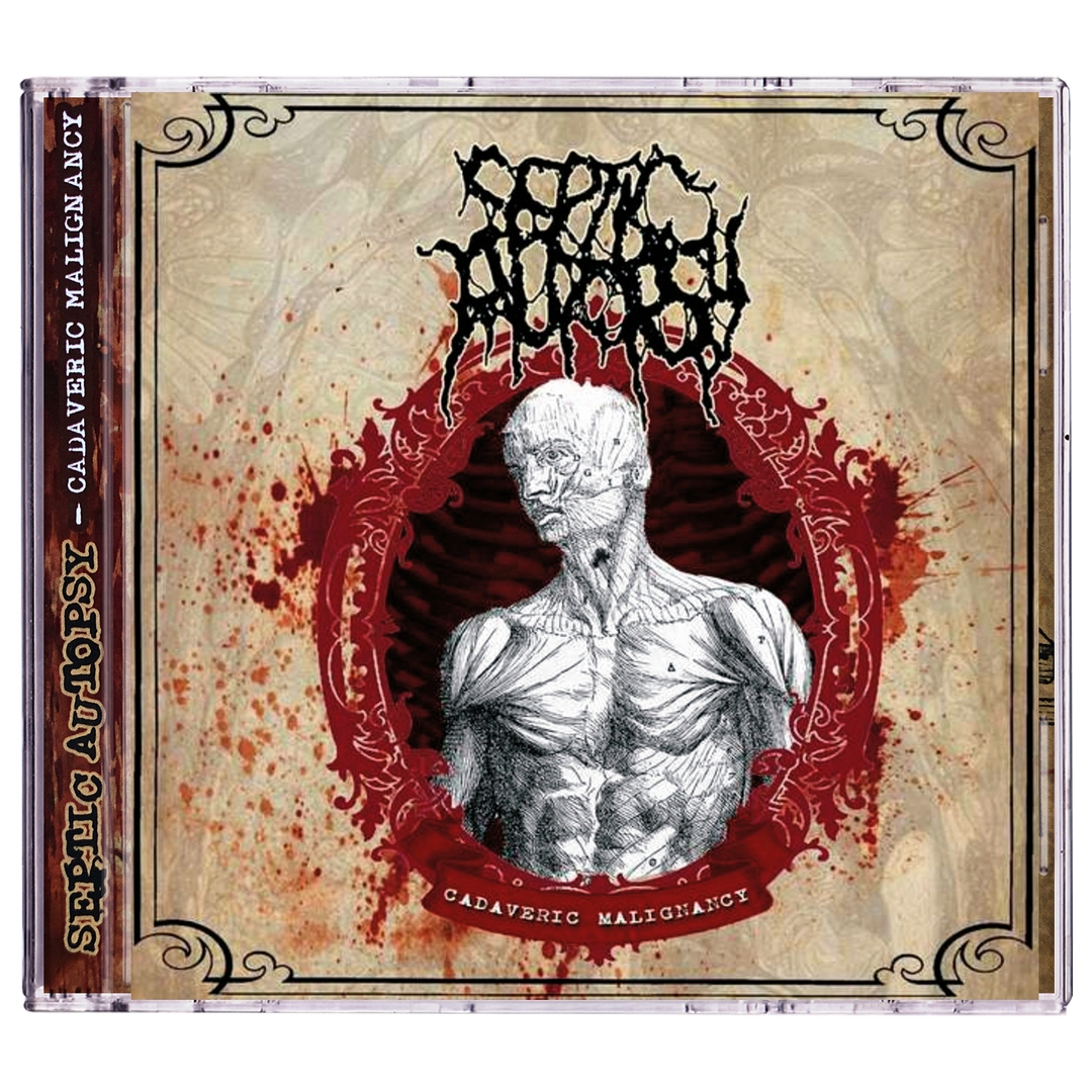 Septic Autopsy 'Cadaveric Malignancy' CD