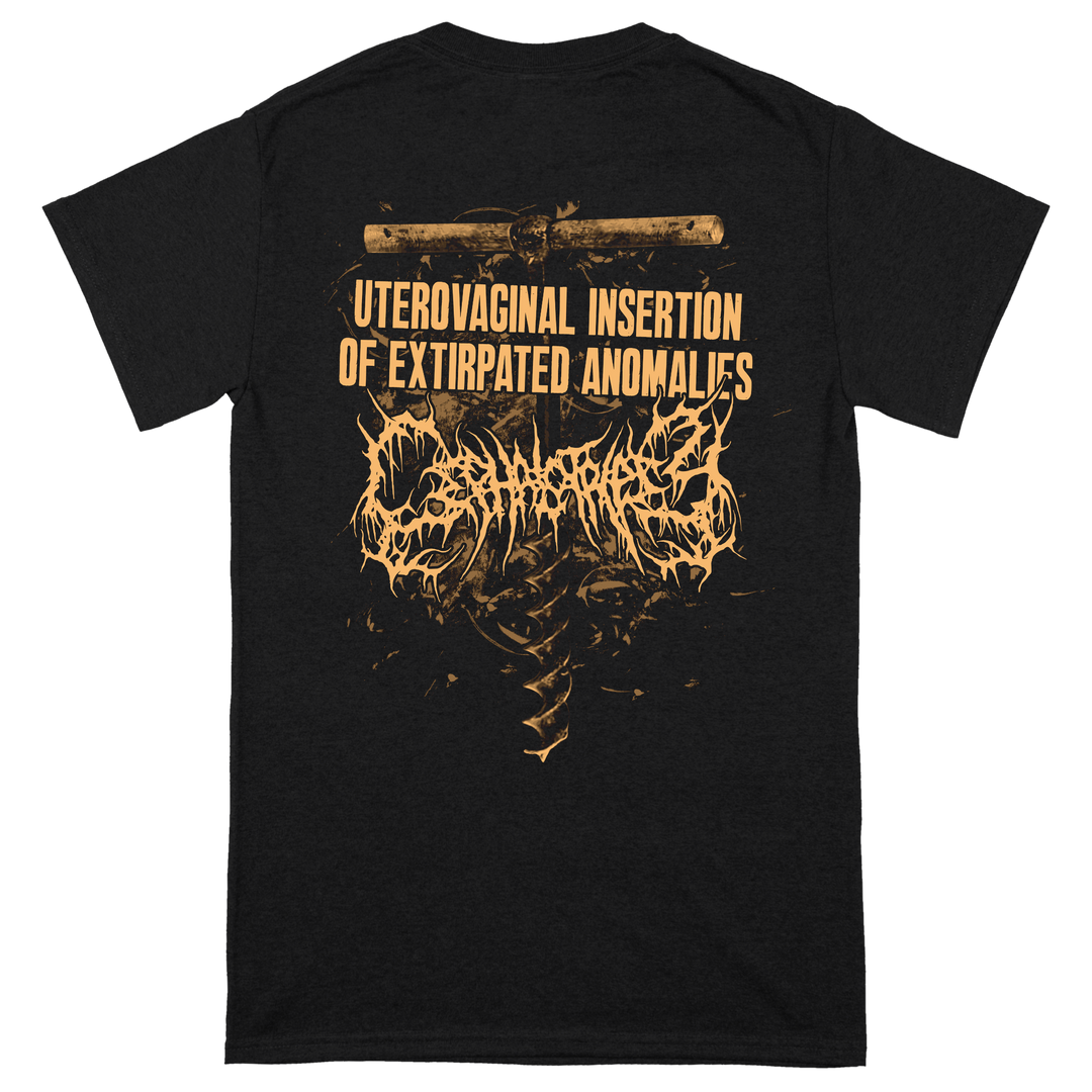 Cephalotripsy 'Uterovaginal' T-Shirt
