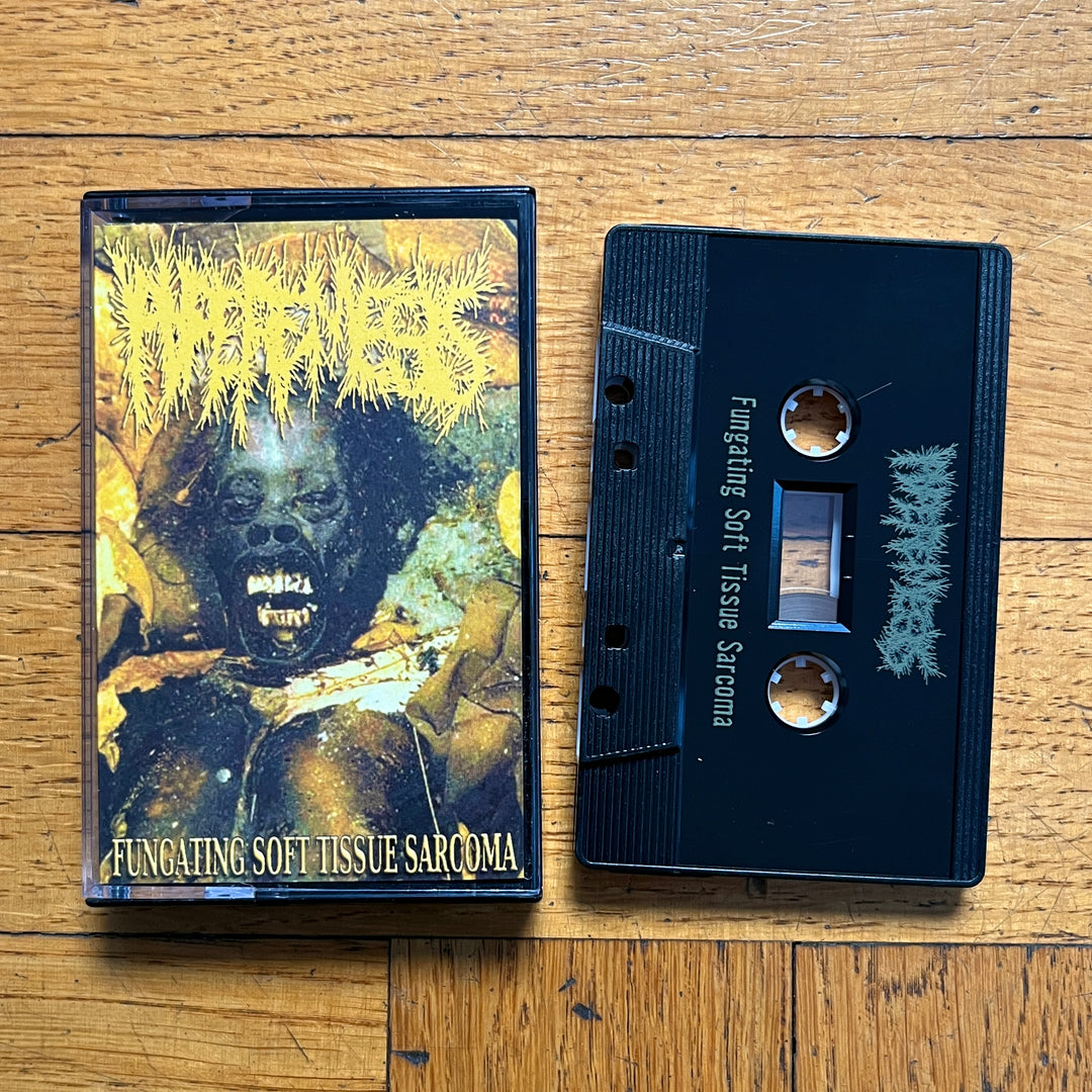 Archagathus / Hyperemesis 'Split Tape' Cassette