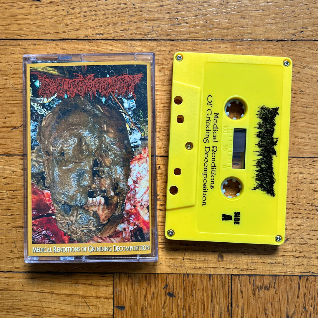 Pharmacist 'Medical Renditions Of Grinding Decomposition' Cassette