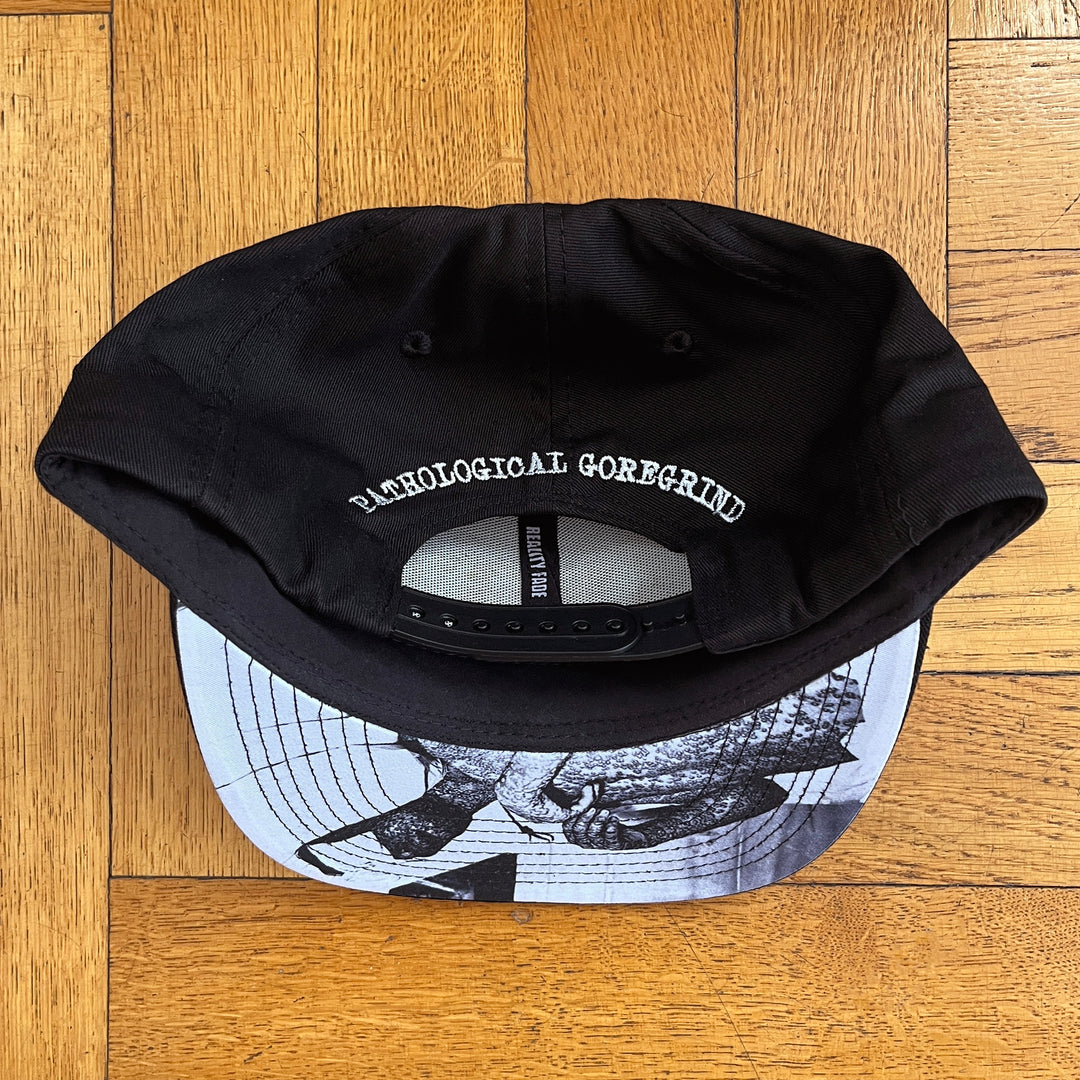 Lipoma 'Odes to Suffering' Snapback