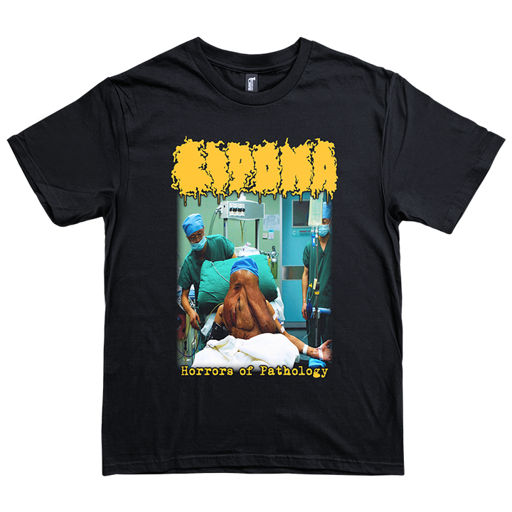 Lipoma "Horrors of Pathology" T-Shirt