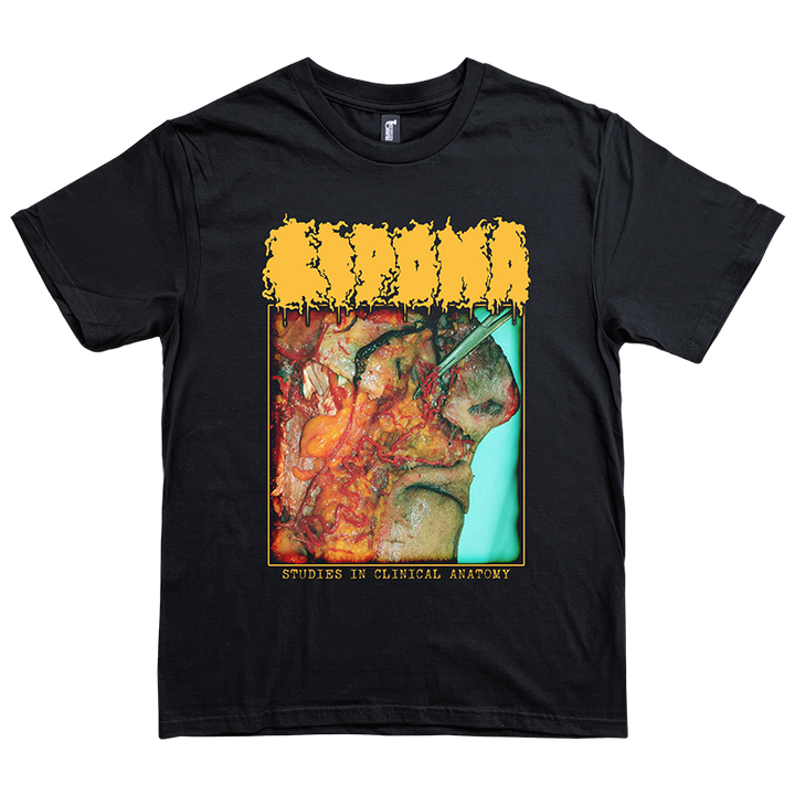 Lipoma "Studies in Clinical Anatomy" T-Shirt