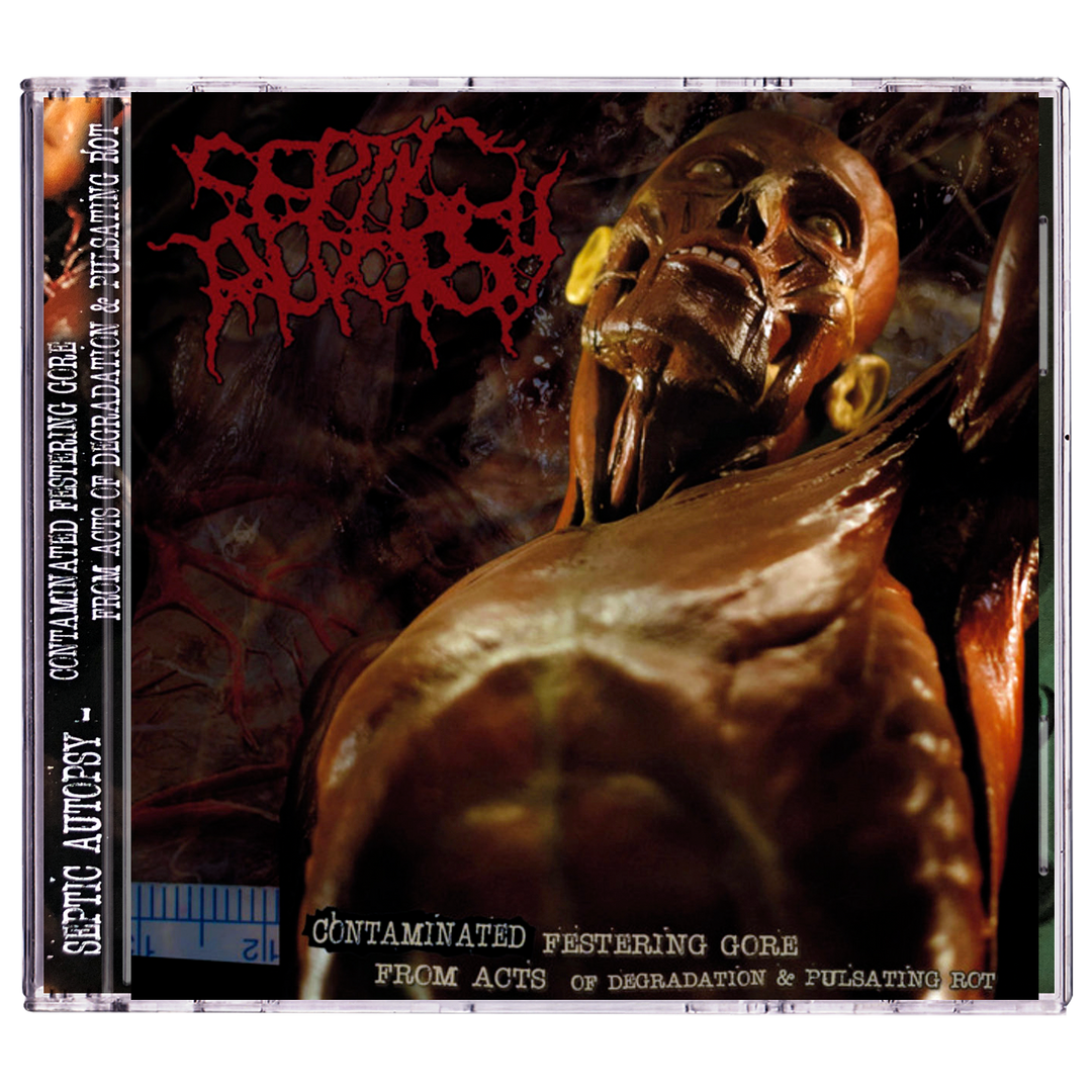 Septic Autopsy 'Contaminated Festering Gore From Acts of Degradation & Pulsating Rot' CD