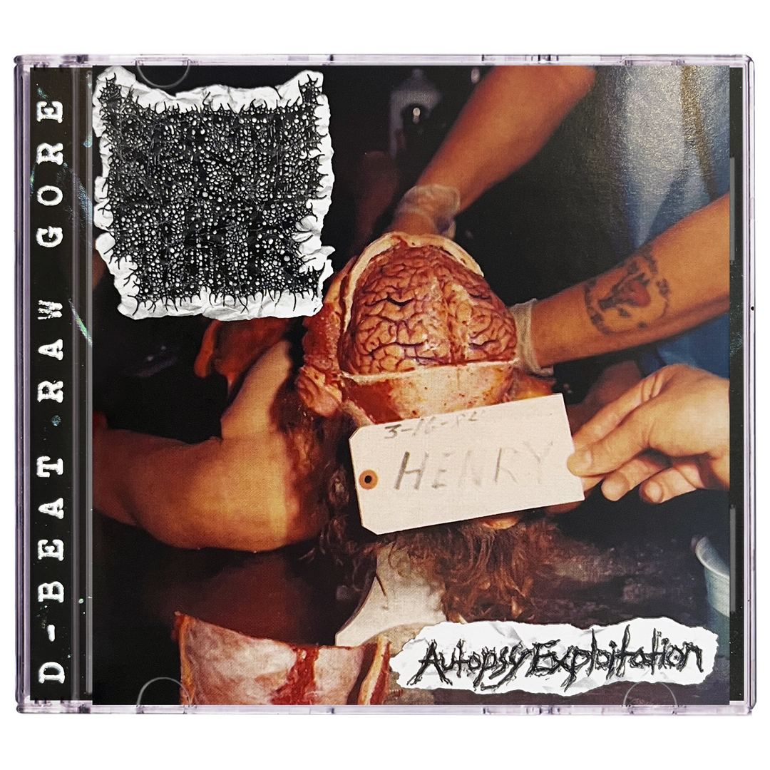 Spastic Tumor 'Autopsy Exploitation' CD