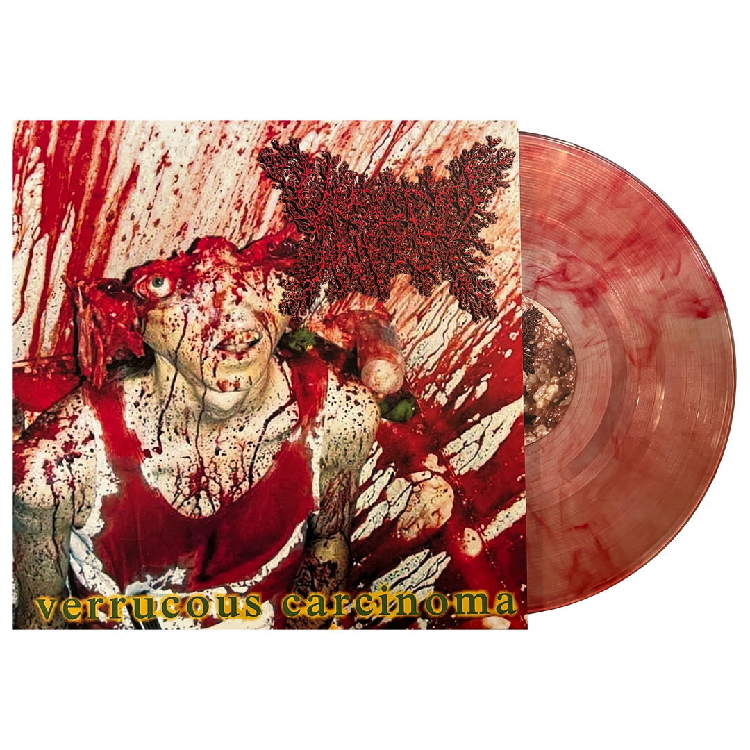 Viscera Infest 'Verrucous Carcinoma' LP